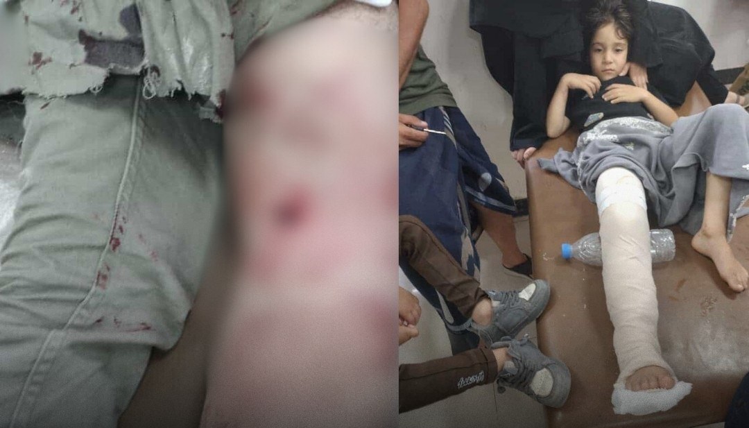 إصابة شخصين أحدهما طفل برصاص قناص حوثي أثناء جلبهما الماء في تعز
