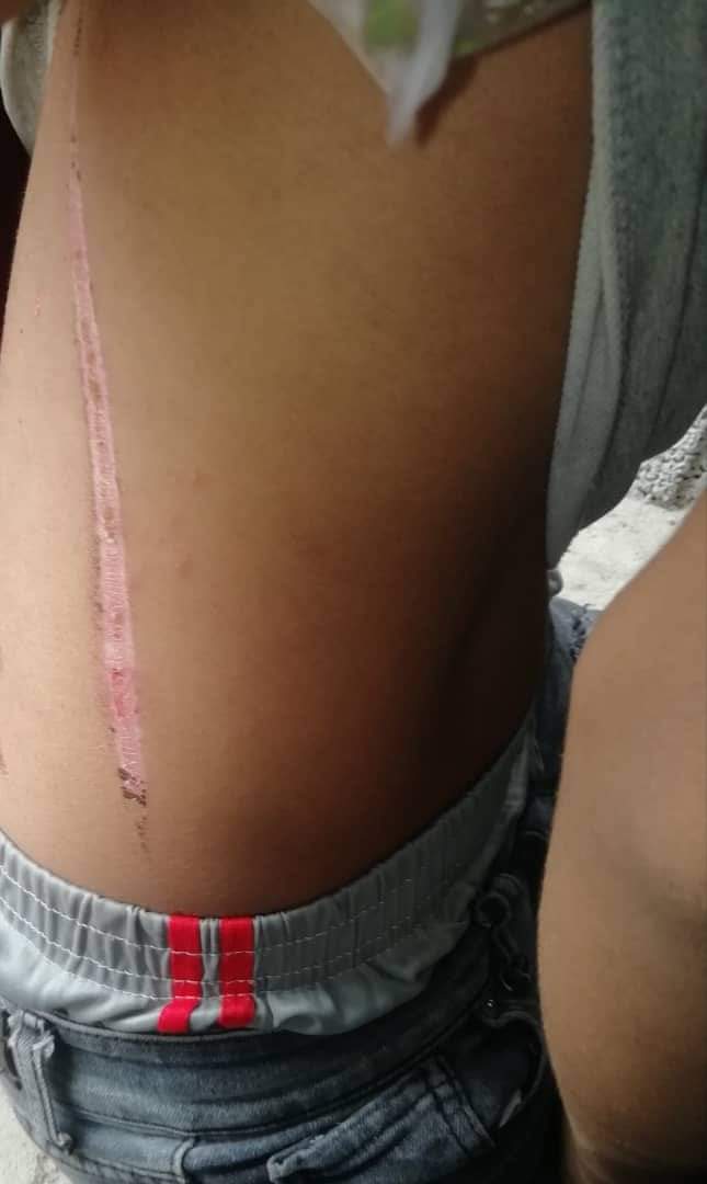 الكشف عن تعذيب أطفال في معتقلات تابعة للواء 13 صاعقة بلحج