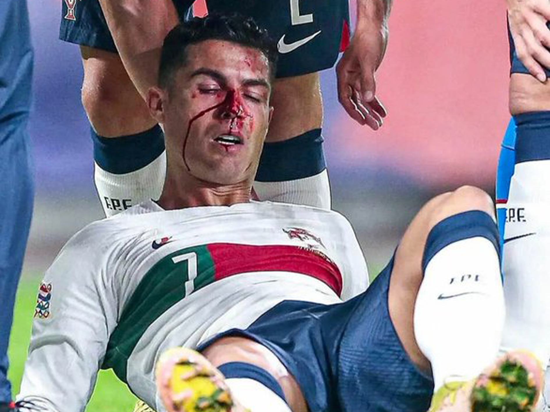 كريستيانو رونالدو.. إصابات نادرة خطفت الأضواء