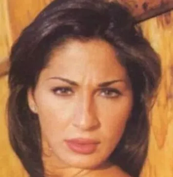 هذه الحسناء هي فنانة شهيرة تغير وجهها تماماً بعد عملية التجميل.. لن تصدق من تكون