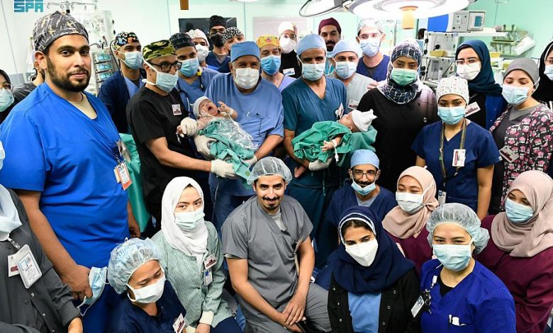 شاهد.. كيف تفاعلت والدة التوأم السيامي اليمني بعد نجاح عملية الفصل